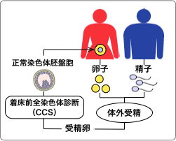 着床前全染色体診断(CCS)プログラム